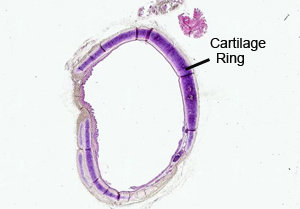 Cartilage Lacunae