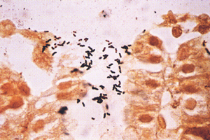 H. pylori