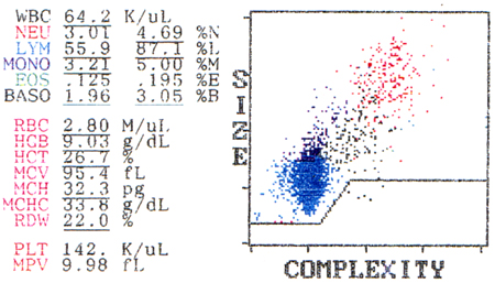 Chronic lymphocytic leukemia