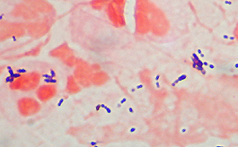 gram stain positive diplococci streptococcus c602web consistent pyogenic capsule bugs four