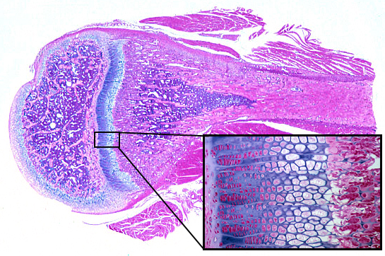 intramembranous ossification histology