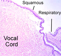false vocal cords histology