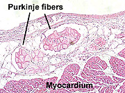 Purkinje fibers histology slide